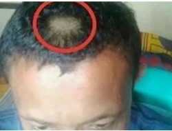 Komisi X DPR-RI Kecam Ortu Balas Cukur Pitak Rambut Guru di Gorontalo